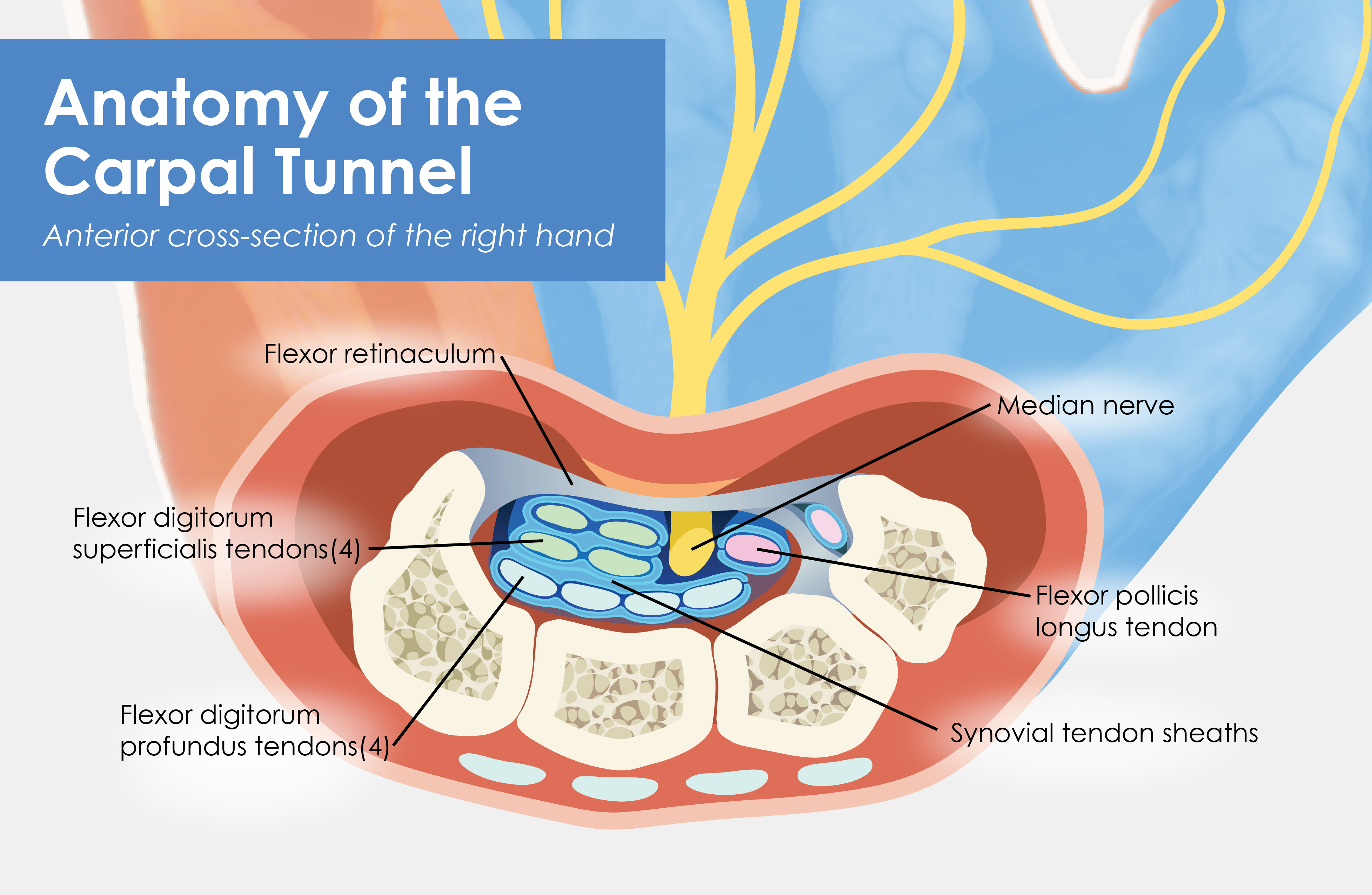 Carpal Tunnel Syndrome | BodyViz Brain Builder